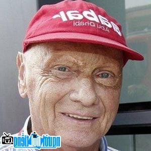 Khuôn mặt Niki Lauda bị biến dạng sau tai nạn.