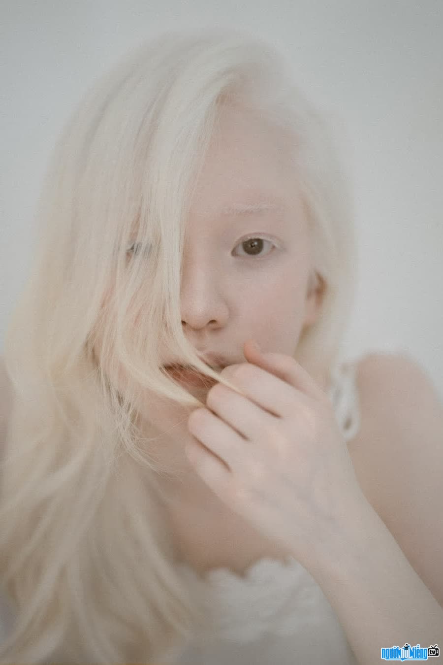 Ngo Thuy Quynh is a girl with albinism