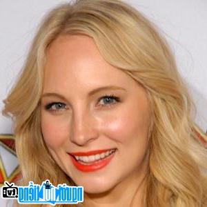 Latest Picture Of Television Actress Candice Accola