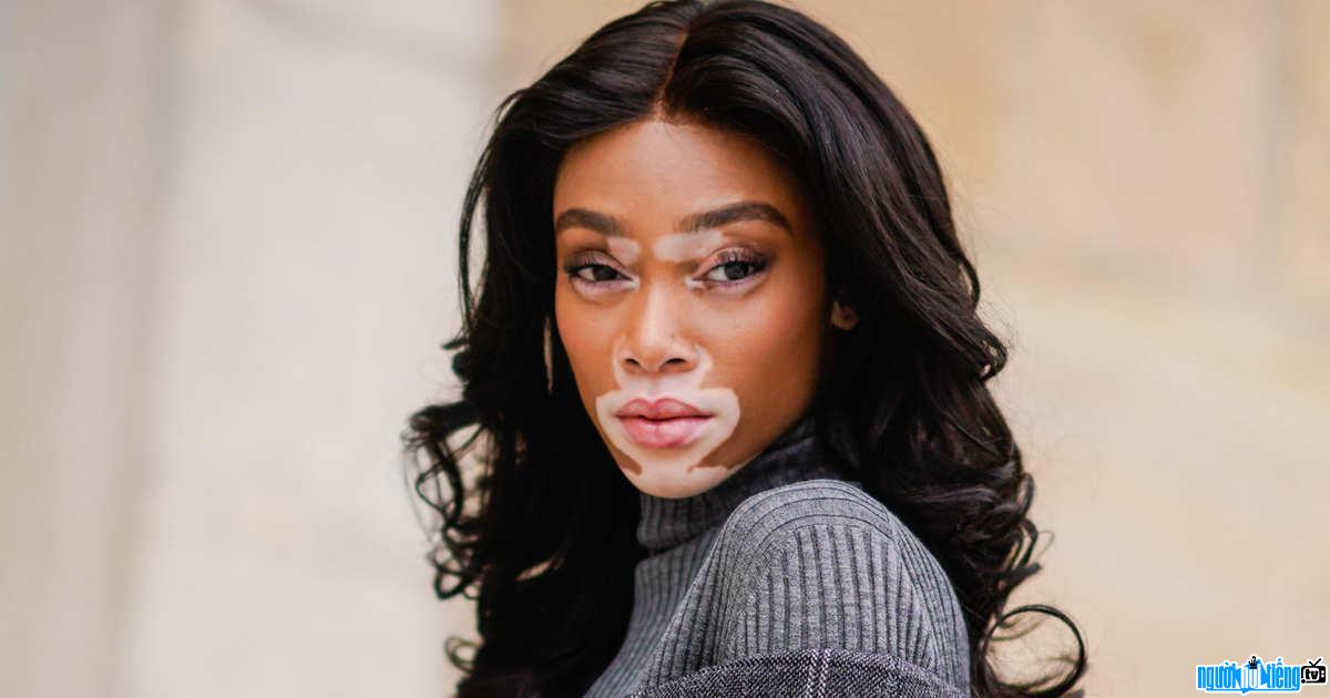New pictures of model Winnie Harlow