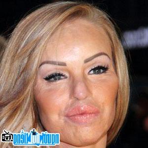 Image of Katie Piper