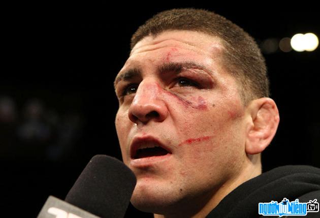 Nick Diaz is an American MMA athlete