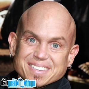 Latest Picture of TV Actor Martin Klebba