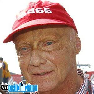 Niki Lauda's face was disfigured after the accident.